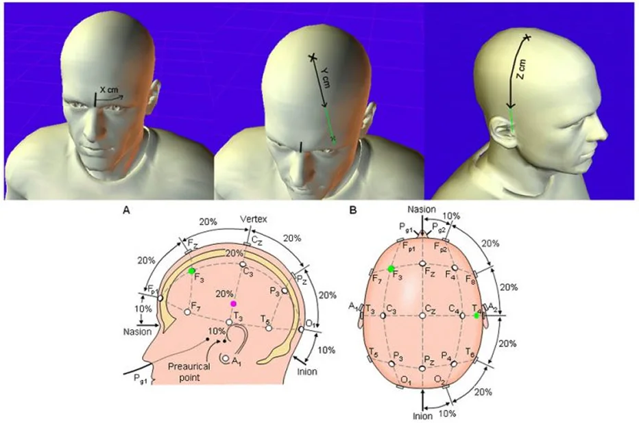 本院TMS定位系統