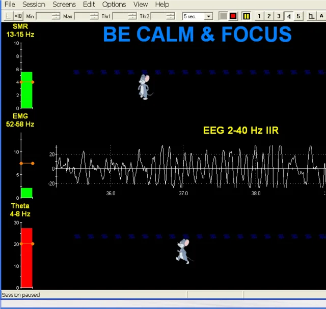腦波神經回饋訓練